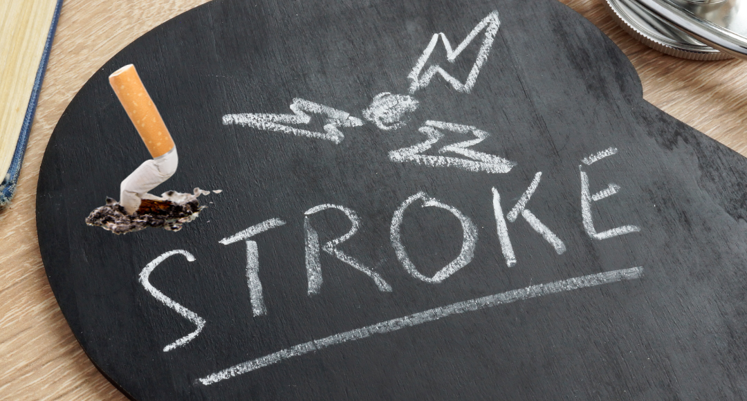 Merokok Sebagai Faktor Risiko Stroke